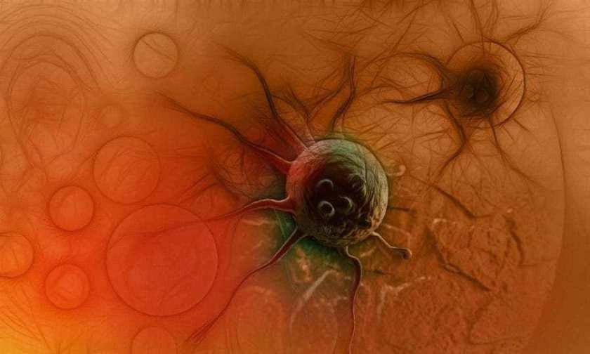 Dr. Deluca: THC/CBD Can Induce Cancer Cell Death Via Apoptosis